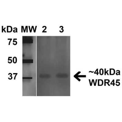 Western Blot: WDR45 Antibody [NBP3-18255]